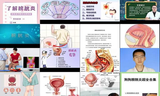 汕头膀胱炎症状