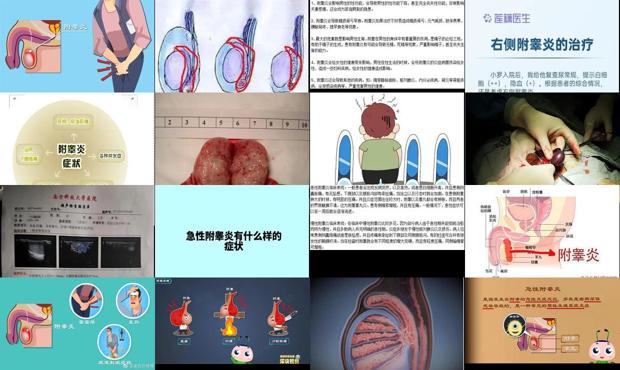 汕头附囊炎的症状