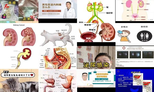 汕头泌尿系统炎症怎么办