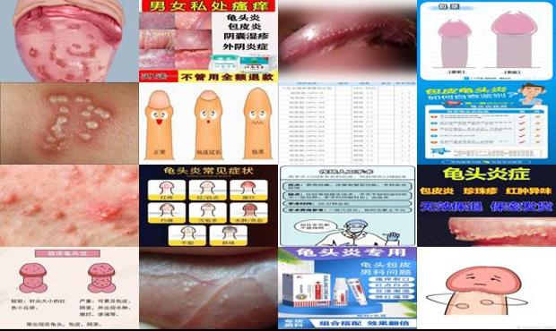 汕头包皮炎是什么症状