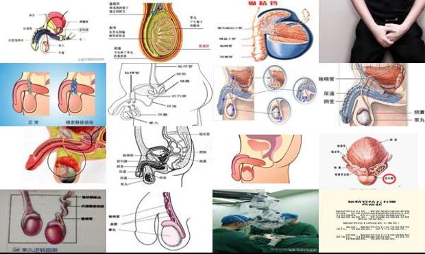 汕头输精管炎症症状