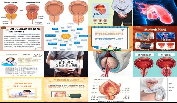 前列腺睾丸胀痛 - 汕头前列腺睾丸一直涨痛