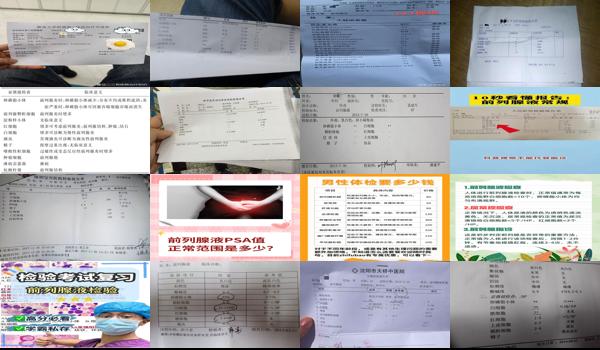 汕头前列腺液常规检查多少钱一次 - 汕头前列腺液常规检查多少钱