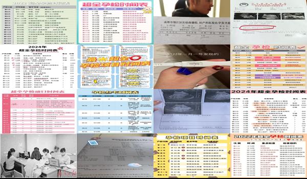 汕头怀孕一月多可以不孕检吗多少钱 - 汕头怀孕一月多可以不孕检吗